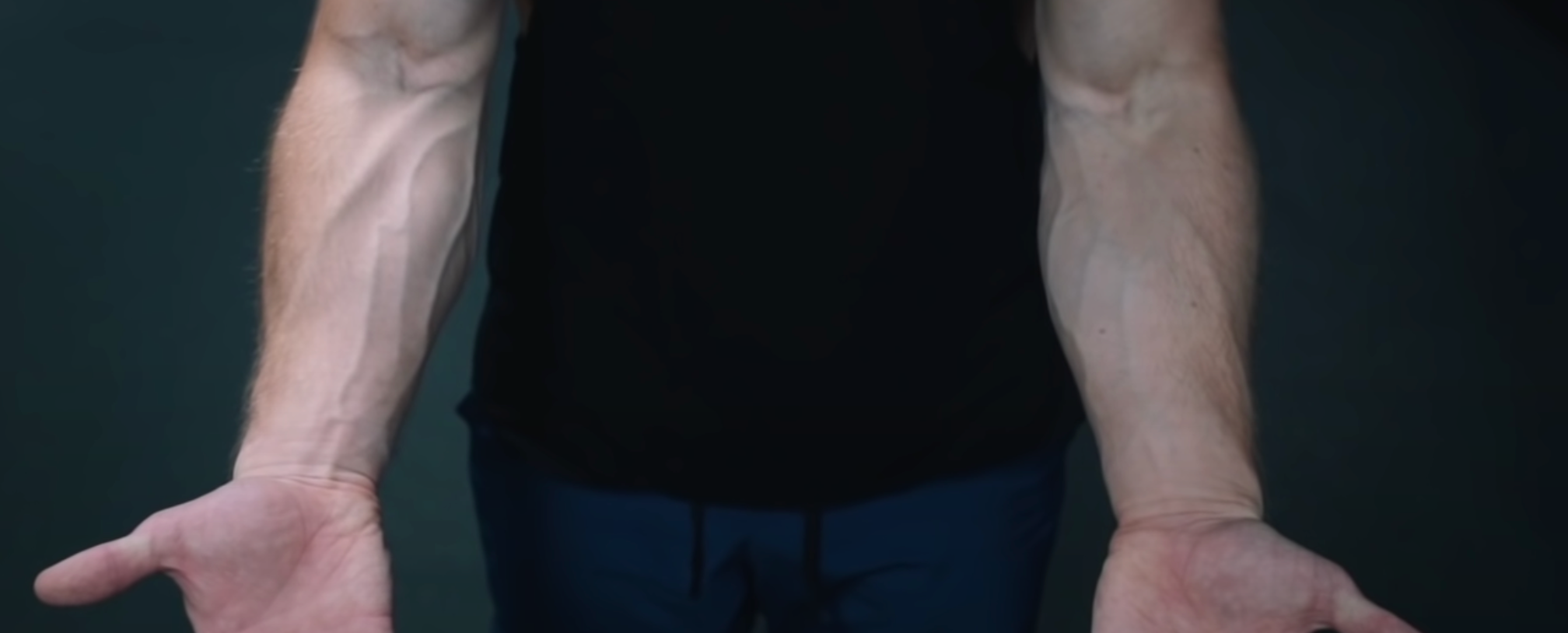 forearms anterior muscles